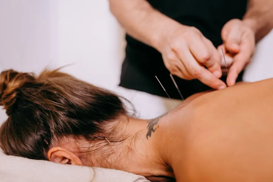Dry needling sur le haut du dos
